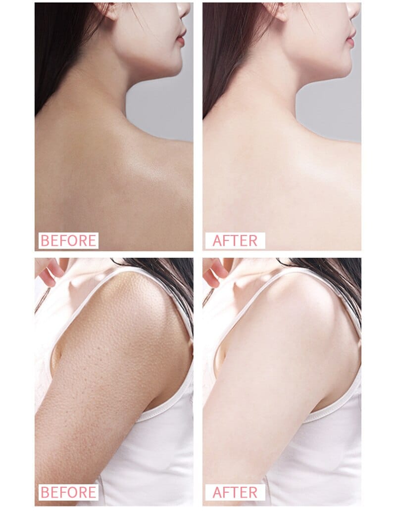 SkinLumyâ„¢ Exfoliating Whitening Cream (Pack of 2)